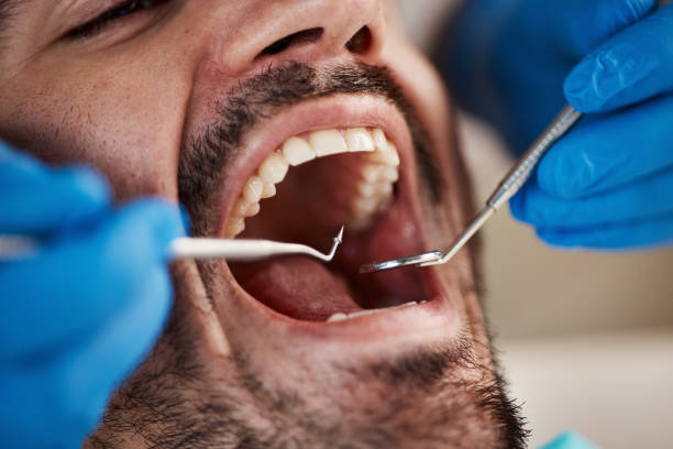 Best Emergency Treatment for Oral Infections in Groves, TX