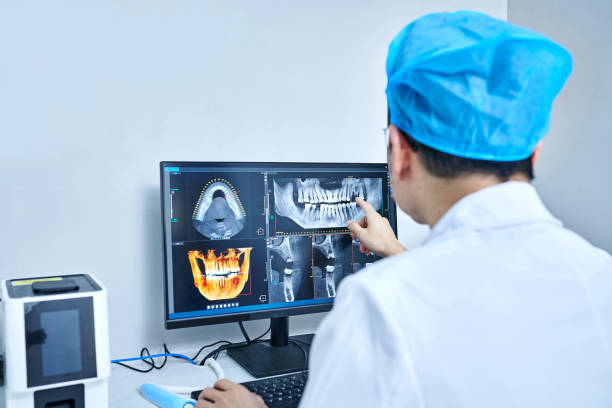 Best Dental Abscess Treatment in Groves, TX